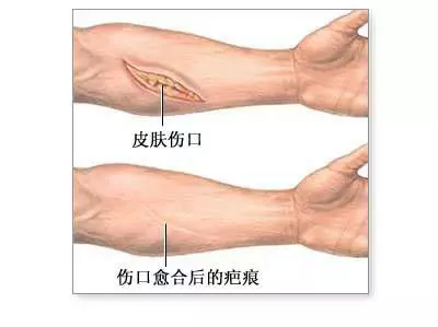 海口疤痕修复机构